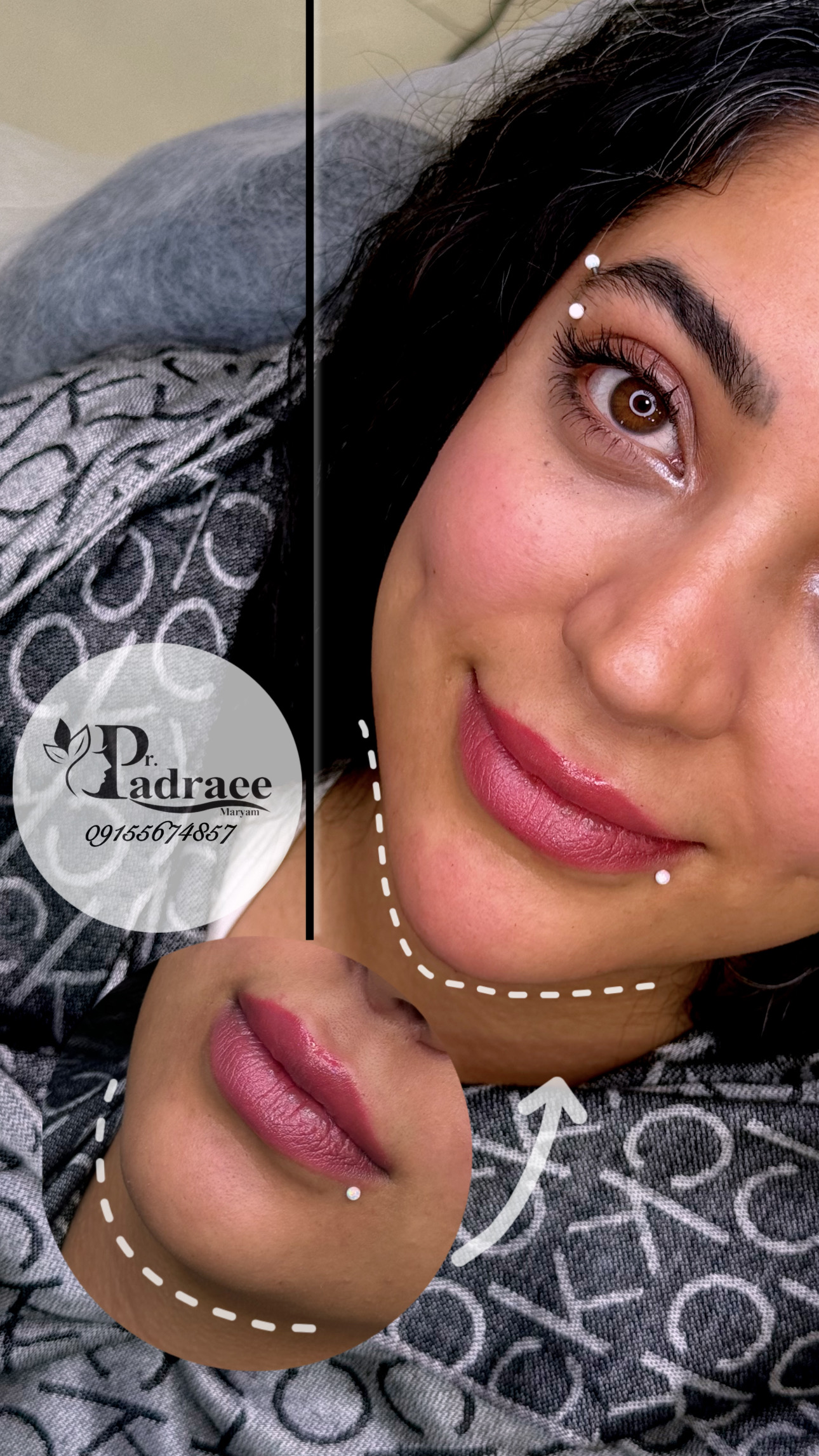 زاویه سازی صورت