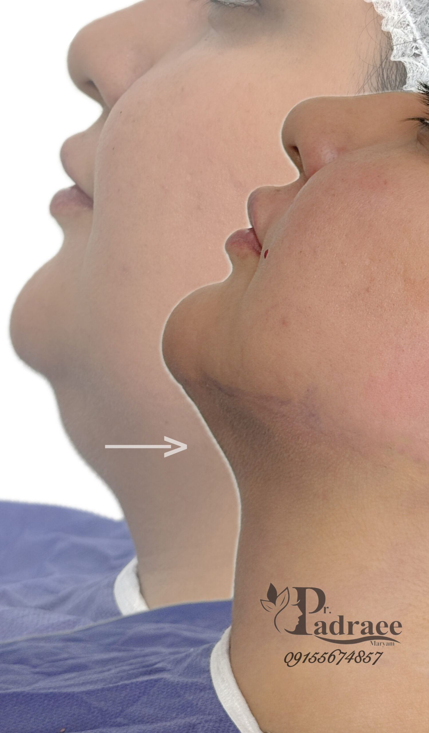 {"pictureId":"14E4F066-9DF6-4065-AA6B-2932AEBD9B95","data":{},"tiktok_developers_3p_anchor_params":"{"source_type":"vicut","picture_template_id":"","capability_name":"retouch_edit_tool","client_key":"aw889s25wozf8s7e"}","editType":"image_edit","exportType":"image_export","source_type":"vicut"}